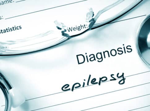 الصرع … رحلة البحث في الأنواع، الأسباب والعلاج