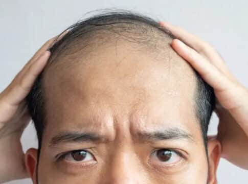 تساقط الشعر … أسبابه وطرق الوقاية منه