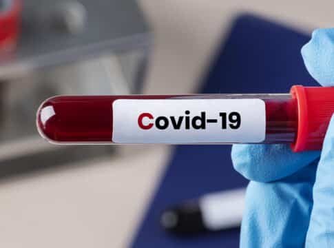 فيروس كورونا … القصة التي لا تنتهي